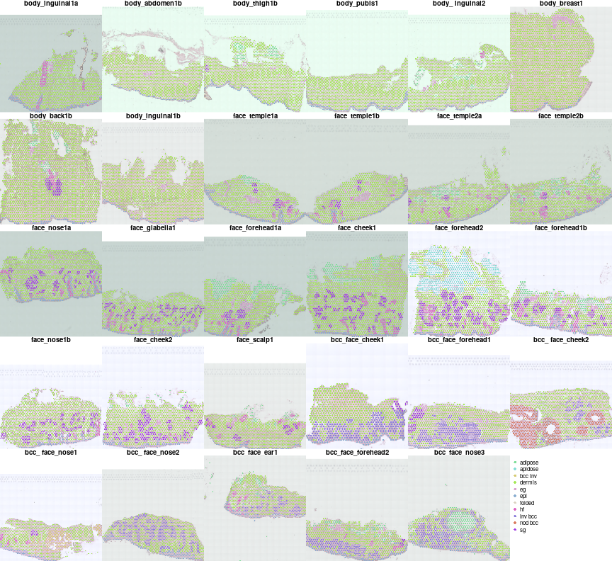 plot of chunk unnamed-chunk-6